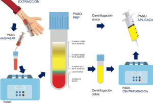 centrifugacion de sangre velocidad de obtencion de plasma