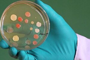 descubre que es una caja de petri y su importancia en la investigacion cientifica
