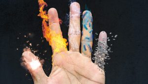 manos quemadas por no usar guantes adecuados