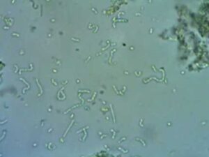 observacion de bacterias del yogurt microscopia al detalle