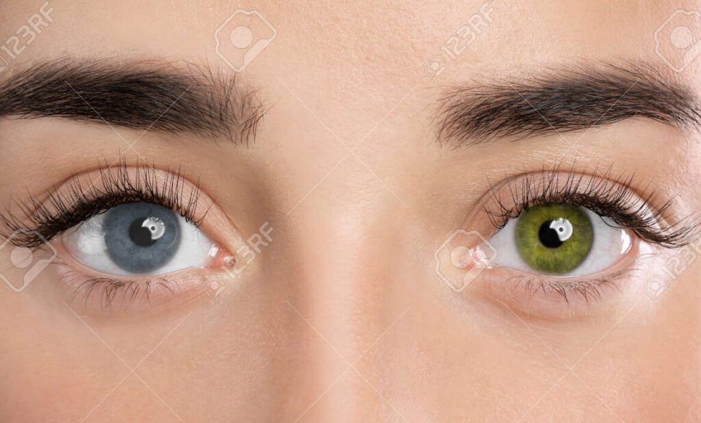 Los ojos más raros del mundo: descubre su belleza única