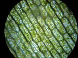 saco para almacenar clorofila en microscopio descubre la solucion perfecta
