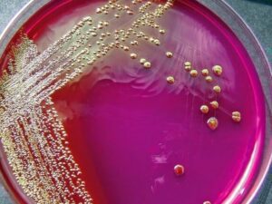 una bacteria multiplicandose en un medio de cultivo